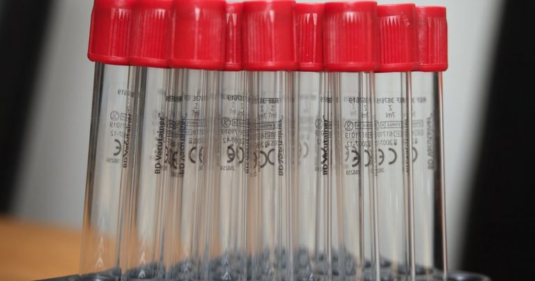Close up row of clear laboratory test tubes with red screw caps