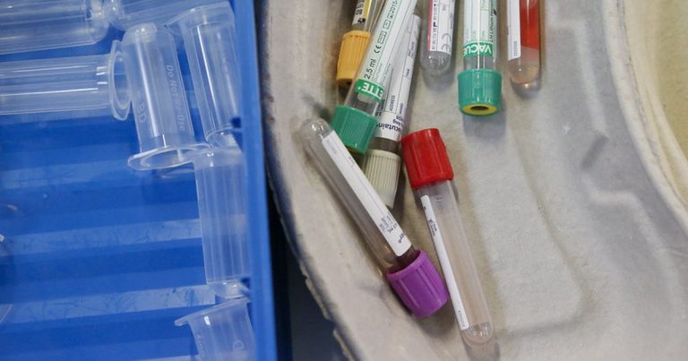Assortment of medical sample vials with different colored caps arranged in a moulded tray