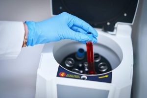 Gloved hand lowering a red topped blood sample tube into a benchtop centrifuge