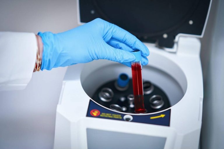 Gloved hand lowering a red topped blood sample tube into a benchtop centrifuge